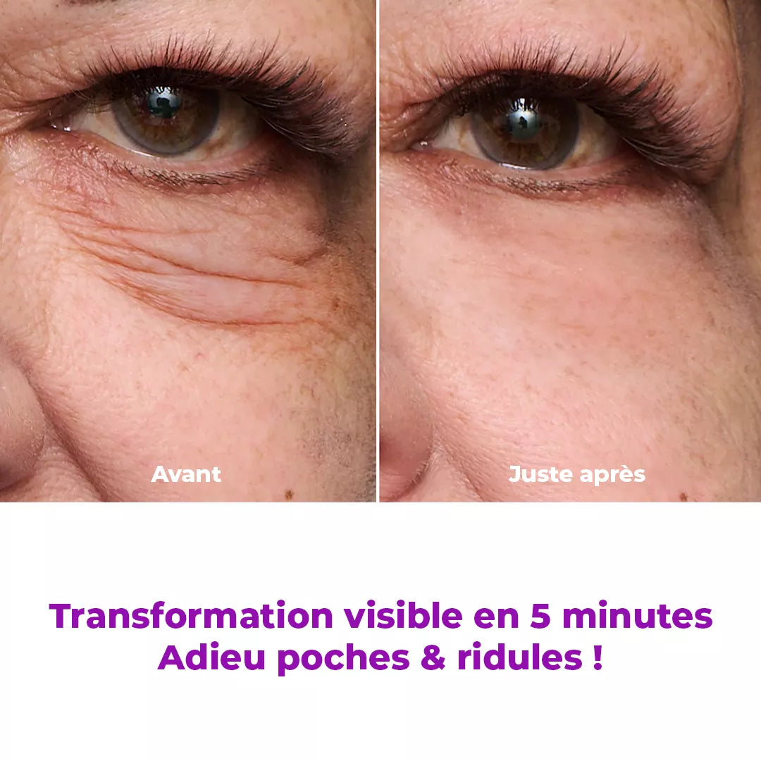 LiftBeauty – Soin Lifting Instantané Qui Lisse Poches, Rides et Ridules Temporairement