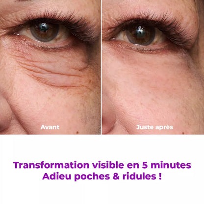 LiftBeauty – Soin Lifting Instantané Qui Lisse Poches, Rides et Ridules Temporairement